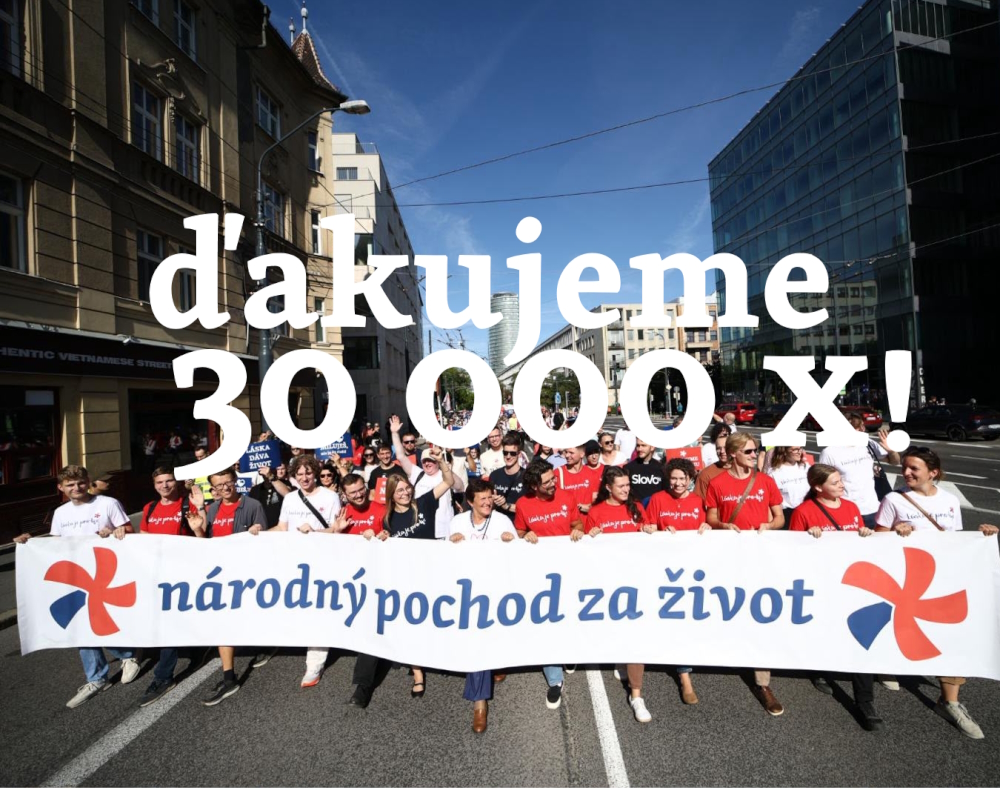 30000x-s